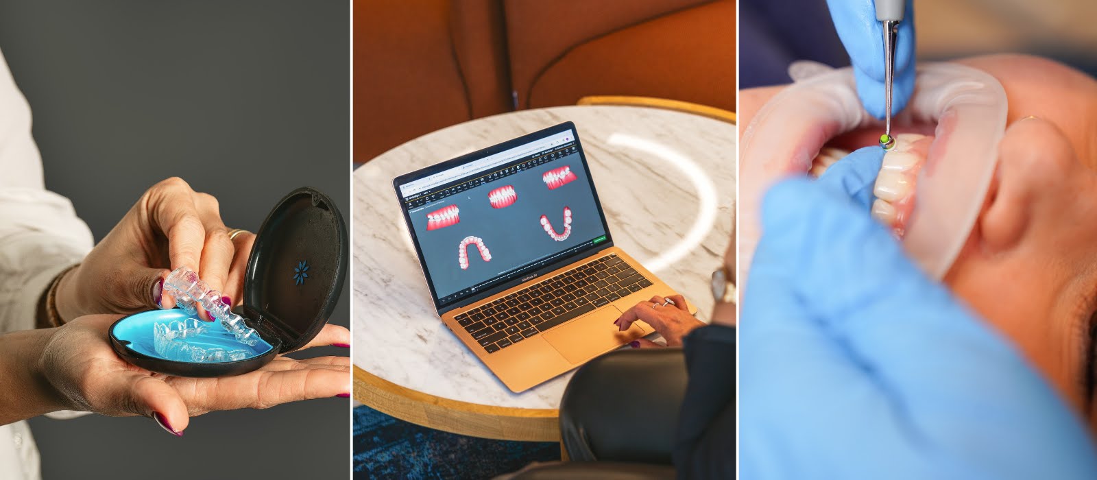 WIN a €500 teeth whitening and cleaning experience at Seapoint Clinic